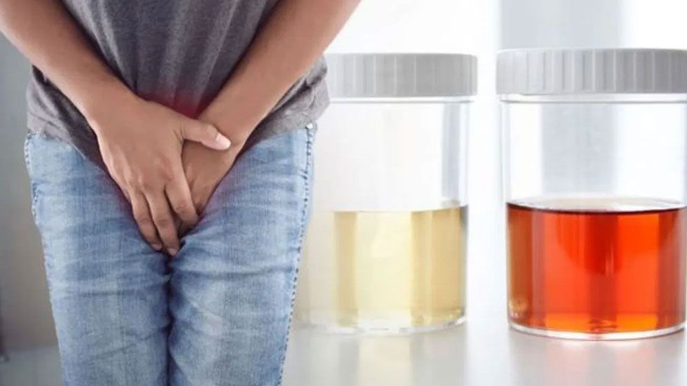প্রস্রাব চেপে রাখলে শরীরে যে ৫টি বড় সমস্যা দেখা দিতে পারে
